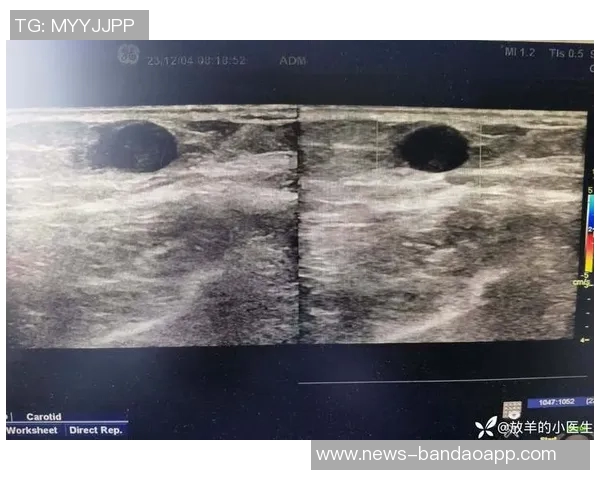 骑士客战绿军梅里尔因右髋部受伤将缺席比赛